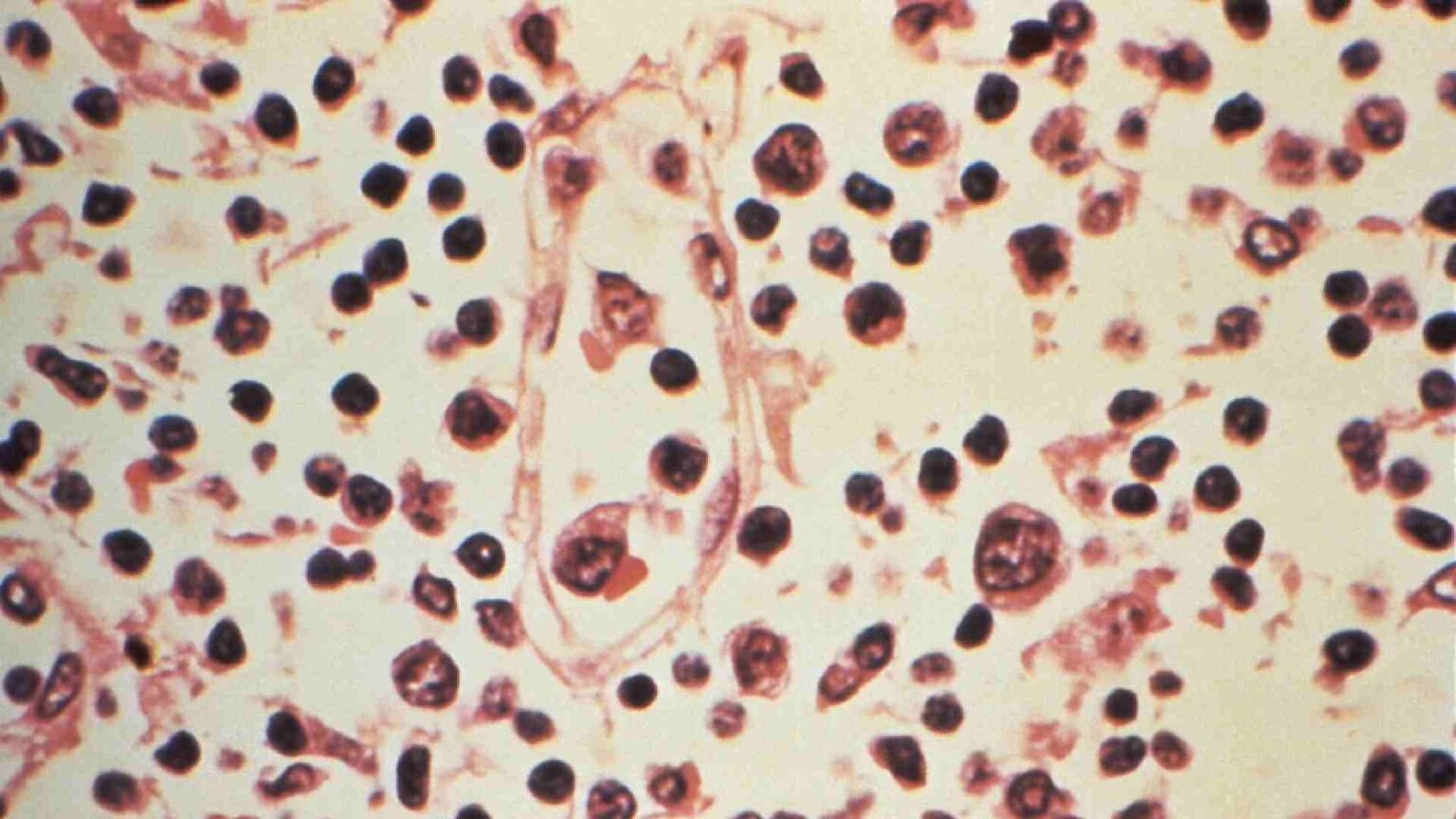 Hantavirus Bajo Microscopio Andes Argentina Chile